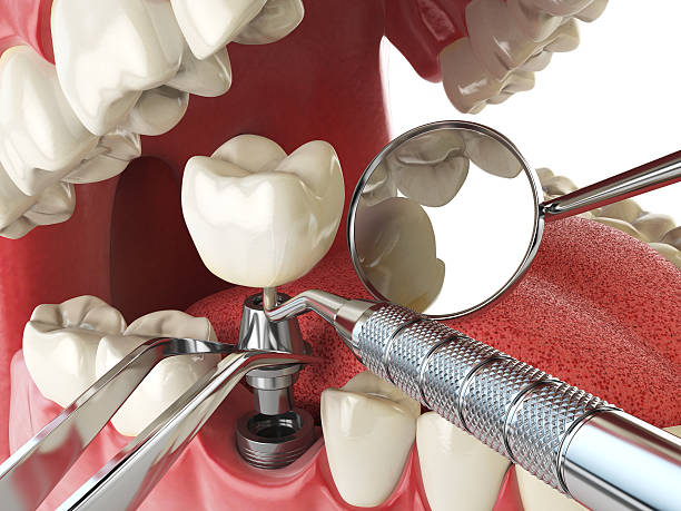 Best Pediatric Emergency Dentist in Loudoun Lley Estates, VA