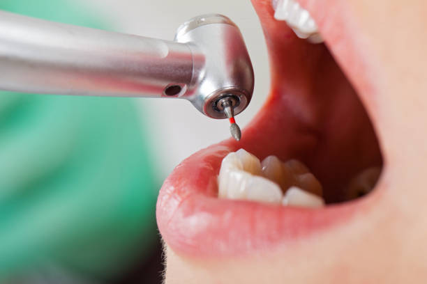 Best Emergency Dental Care for Broken or Chipped Teeth in Loudoun Lley Estates, VA